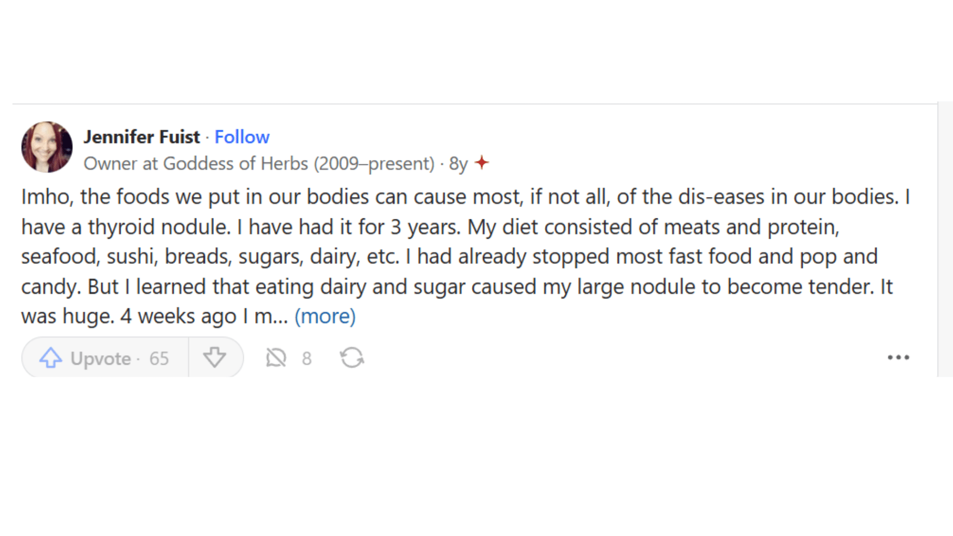Screenshot of quora discussion showing real-life experiences and user stories about shrinking a goiter naturally through lifestyle changes and remedies