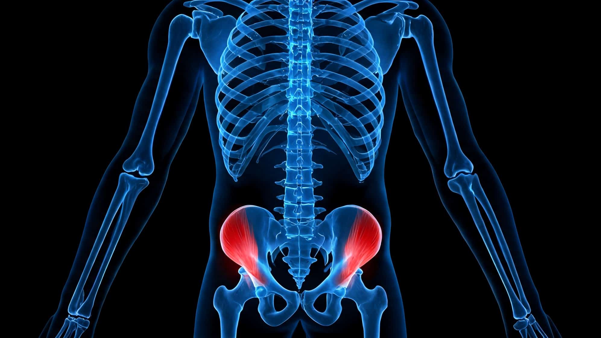 X-ray of a human skeleton with Gluteus Medius muscles highlighted in red over the hips