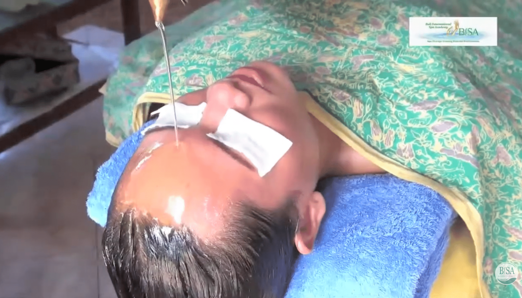 warm oil flows onto client’s forehead during shirodhara massage with eyes covered for comfort