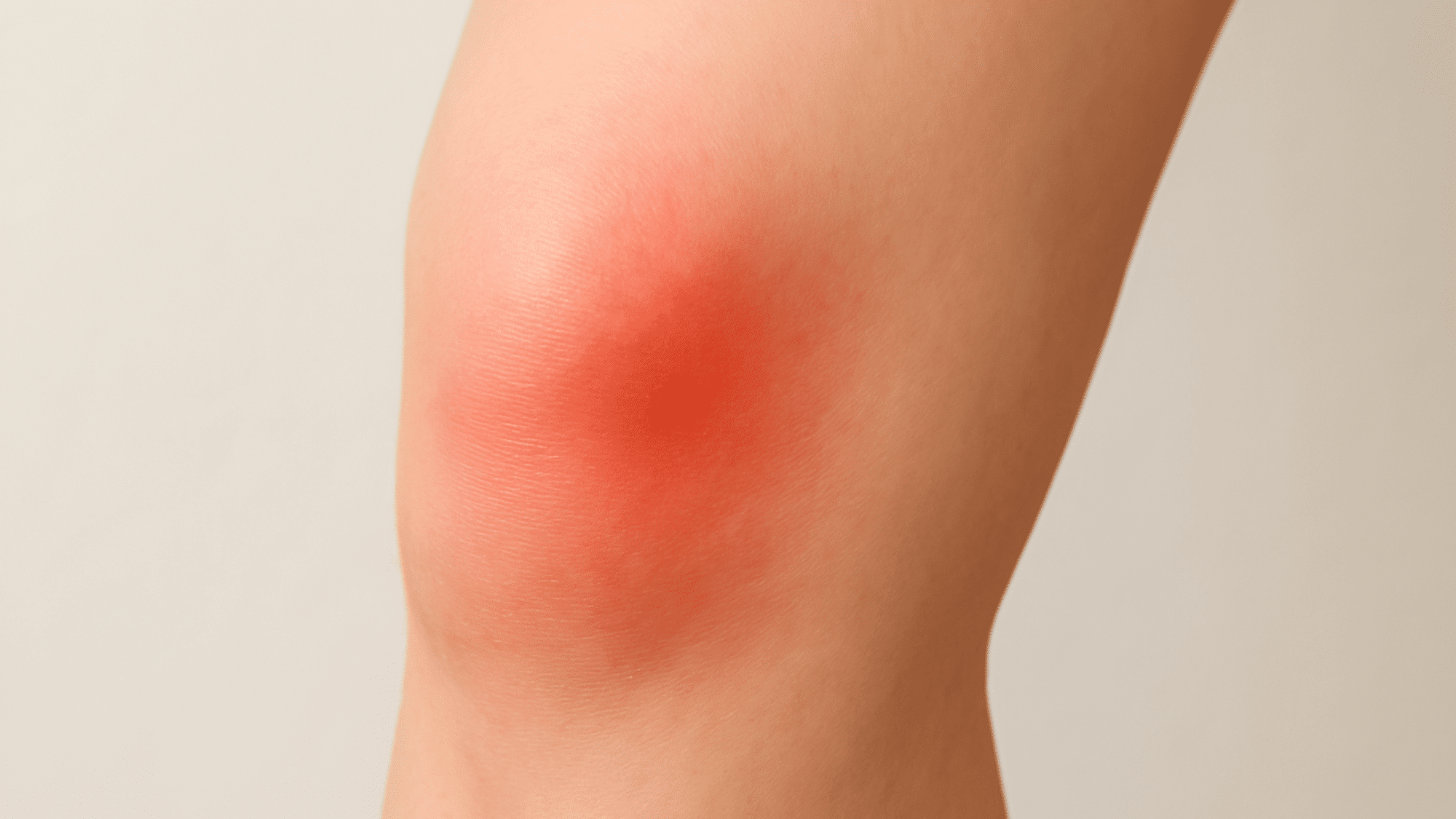 sharp pain in knee cap